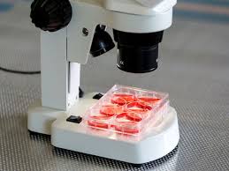 white blood cell count and differential