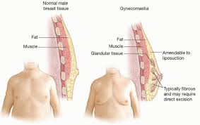 Which are the shoulder muscles and where they are located? Gynecomastia Plastic Surgery Key