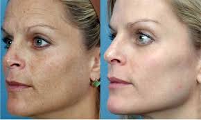 Amy Bautista (amymichelle222)