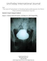 Image result for Voiding Cystourethrogram