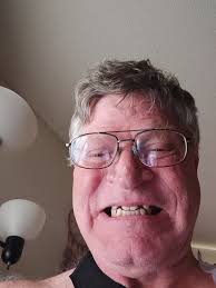 Well, not feeling too handsome...lol. but here are my pics. Implants