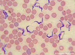 Lange waren nur vier erreger bekannt, die beim menschen malaria auslösen: Mediendatenbank Biologie Krankheitserreger