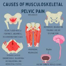 Image result for Pelvic Floor Dysfunction