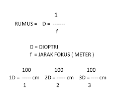 Agar dapat melihat normal kembali maka penderita cacat mata ini dapat ditolong dengan menggunakan kaca mata berlensa positif konvergen dengan kekuatan lensa sebesar. Kelainan Refraksi Bagian I K Mata Fakultas Kedokteran Universitas Wijaya Kusuma Surabaya Ppt Download