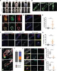 Jun 08, 2021 · of course the former a+ list teen actor turned a+ list grifter wants in on the nft grift. Pnkp Is Required For Maintaining The Integrity Of Progenitor Cell Populations In Adult Mice Life Science Alliance