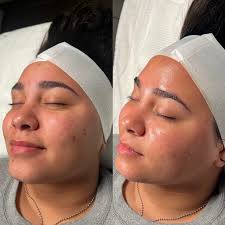 Happy small business Sunday 😁 I am the owner and Esthetician of Fern &  Cedar Skincare I specialize in facials and waxing services ✨ I treat a  variety of skin concerns and