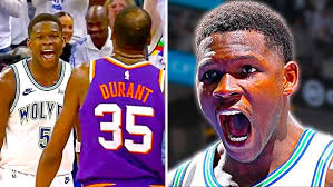 Anthony Edwards hit his head