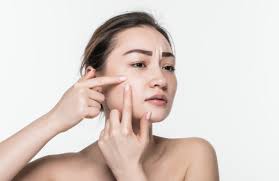 Tại sao dưỡng ẩm da vẫn khô? - Báo VnExpress Sức khỏe