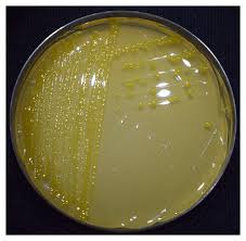 Image result for tomato seedling xanthomonas vesicatoria