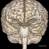Maybe you would like to learn more about one of these? Territory Of Anterior Cerebral Artery Cortical Branches