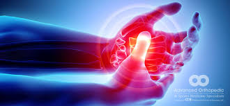 If you have wrist pain, it's almost guaranteed that you have a c grade or worse with the wrist and finger extension test. Nerve Pain In Your Hand Advanced Orthopedic Sports Medicine