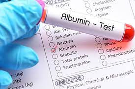 Albumin Funktion Krankheiten Medlexi De