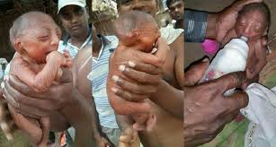 3 Fruits A Eviter Pendant La Grossesse Qui Peuvent Deformer Votre Bebe