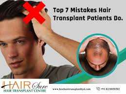 Hair transplantation is a method by which the lost hair is restored by a method of surgery. Top 7 Mistakes Hair Transplant Patients Do Cyber Hairsure