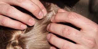 You are more valuable to god than a whole flock of sparrows. What Is Scalp Acne How To Treat Pimples On Your Scalp Allure