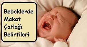 bebeklerde makat catlagi saglik haberleri bebek saglik haber
