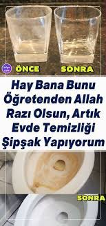 temizlik yontemleri panosundaki pin