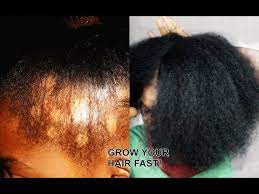 Your Hair Will Never Stop Growing If You Use This Oil Magic Hair Growth Oil Youtube Magic Hair Hair Growth Oil Growth Oil