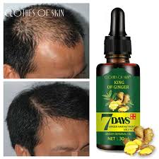 To give yourself a hot oil treatment, massage the oil into your scalp and then apply it all the way to the ends of your strands. New Upgrade Hair Loss Treatment Ginger Hair Growth Serum Shopee Philippines