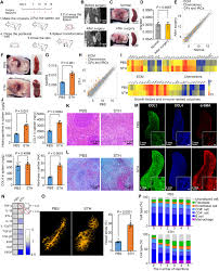 An enlarged spleen puts one at risk for rupture, said. Transforming The Spleen Into A Liver Like Organ In Vivo Science Advances