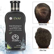Amazon Com Men Shampoo Anti Hair Loss Hair Growth Treatment Natural Effective Solution For Hair Thinning Breakage Hair Loss Treatment Helps Stop Hair Loss Stimulates Hair Re Growth Dandruff Treatment 200ml Beauty men shampoo anti hair loss hair growth
