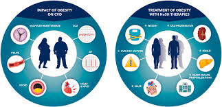 Image result for Obesity Management