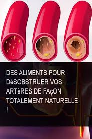 Des Aliments Pour Desobstruer Vos Arteres De Facon Totalement Naturelle Naturelle Aliments Aliment Artere Arteres Lava Lamp Novelty Lamp Novelty