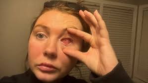 Fundraiser by sarah sullivan : Support Shannon's Eye Recovery Journey