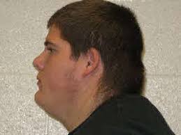 Murder suspect who appealed the state as having weighed down to 140 kilos  in prison