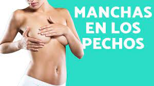 Manchas En Los Pechos Por Que Salen Manchas En Los Pechos Youtube