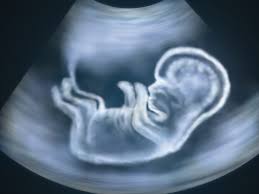 Image result for Ultrasound