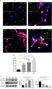 Spontaneous formation of neutrophil extracellular traps is associated with  autophagy | Scientific Reports