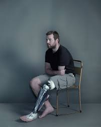 far out on a limb amputee model body positive photography prosthetic leg