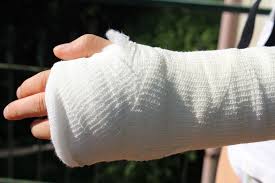 Image result for Hand Injury