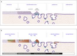 Rare cases may harbor in situ or invasive squamous or glandular lesions. Refining Our Understanding Of Cervical Neoplasia And Its Cellular Origins Sciencedirect
