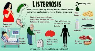 Discover 10 common listeria symptoms at 10faq health and stay better informed to make 10 listeria symptoms. Listeriosis