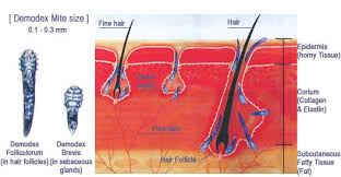Image result for Demodex brevis