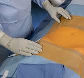 Sterile Universal General Pack Surgery Head Hip Aperture Surgical Drape  Sheet