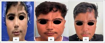 Clinical Case Reports: Vol 12, No 5