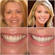 RELIANCE DENTAL DESIGNS