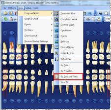 dentrix tip tuesdays viewing by selected teeth in the