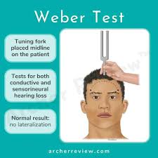 Image result for Tuning Fork Test
