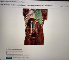 Solved 4 Cardiovascular Blood Vessels Pals Pal Models Chegg Com