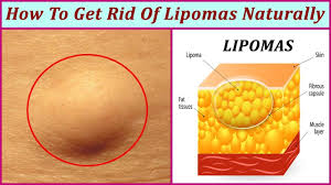 Pin On Health Home Remedies