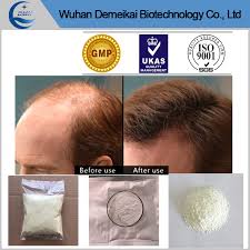 On average, hair tends to grow between 0.5 and 1.7 centimeters per month. Oral Use Finasteride Powder Help Reduce Dht To Slow Hair Loss China Finasteride Finasteride Powder Made In China Com