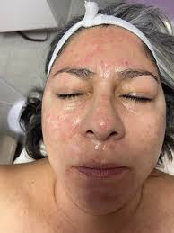 Rejuvenate Skin by Maribel