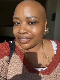 Breast cancer survivor prefers being bald