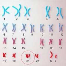 Meiosis Mistakes Let S Talk Science
