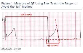 Long Qt Syndrome And Competitive Sports Aer Journal