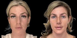 Cory S. Goldberg, BSc, MD, FRCS(C), Certified Plastic Surgeon